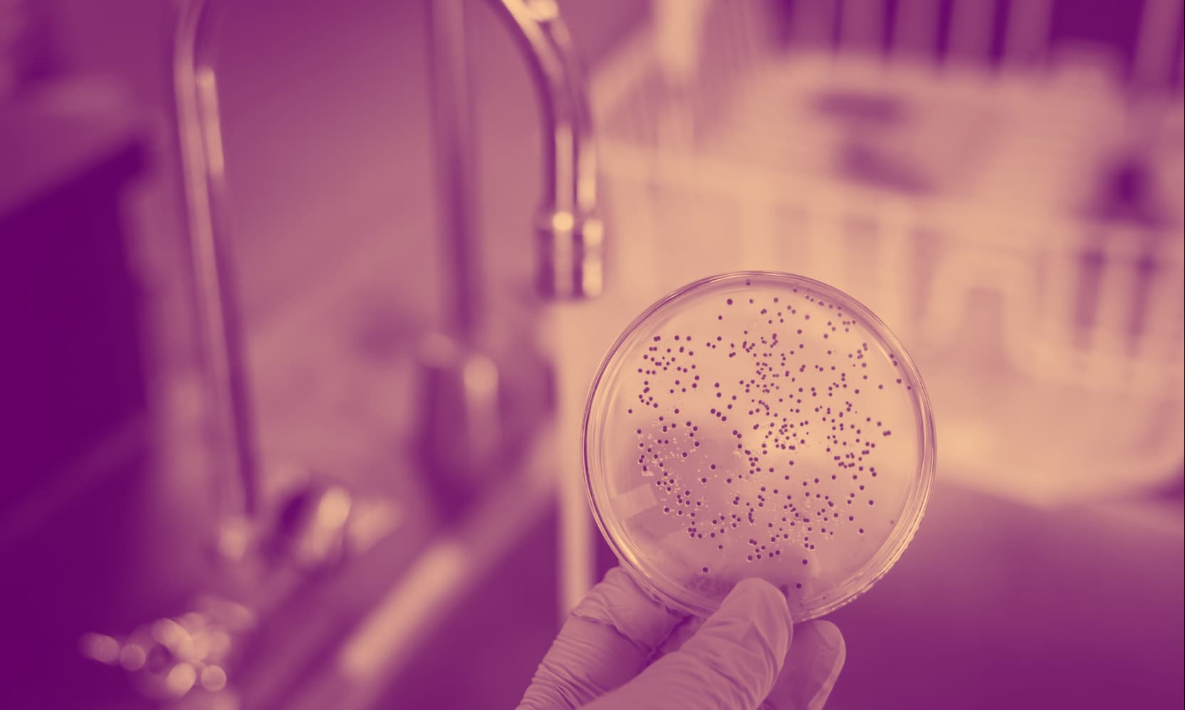 4 Major Biological Hazards in Food Causes, Examples, Prevention Tips